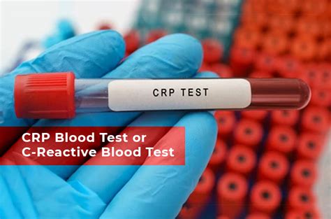 crp blood test bottle|what is crp nhs.